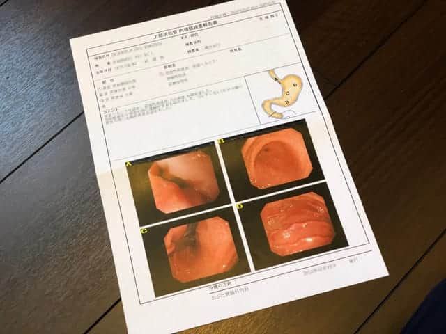 診察結果とその後の胃の症状