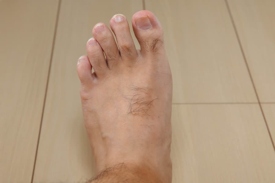 足の親指と甲の毛の拡大写真