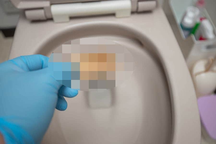 【閲覧注意】トイレの中からデカい尿石が取れた！輪ジミもスッキリ！