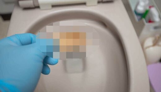 【閲覧注意】トイレの中からデカい尿石が取れた！輪ジミもスッキリ！